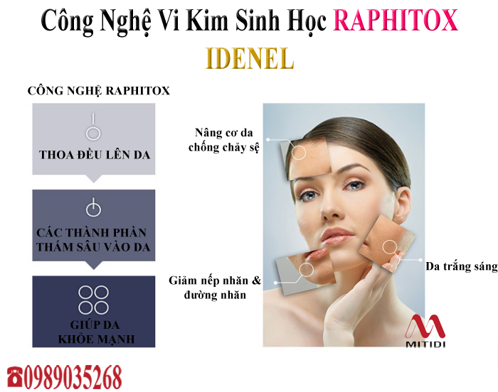 Vi kim sinh học Idenel Raphitox Vi kim sinh học Idenel Raphitox 06.jpg (174 KB)